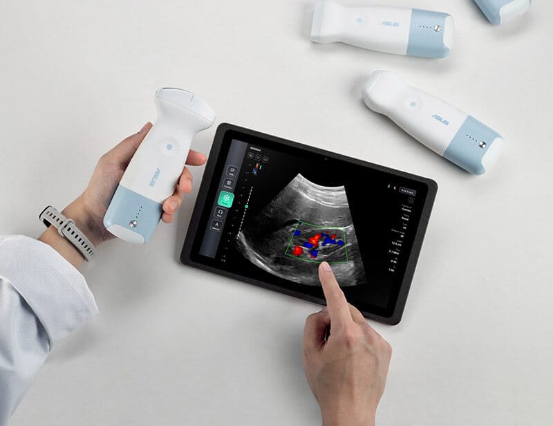 Mano sosteniendo un ecógrafo portátil ASUS mientras se muestra una imagen de ultrasonido en una tablet.