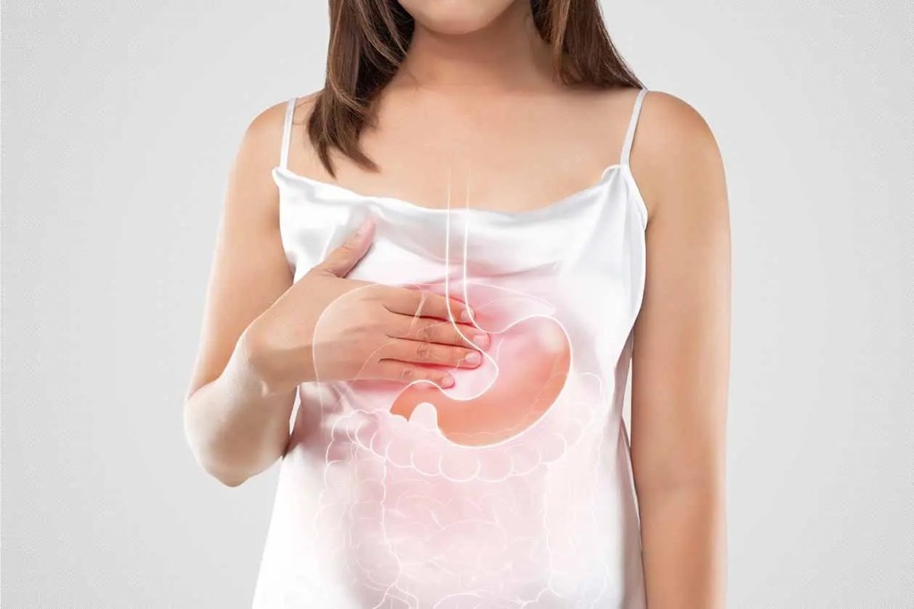 Una mujer se sujeta el abdomen mientras se muestra una imagen estilizada del sistema digestivo en su vestido, simbolizando problemas digestivos.